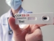 Un medic critică numărul mic de teste: Experiment biologic făcut de guvern