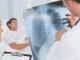 A fost aprobată noua Strategie Națională de Control al Tuberculozei