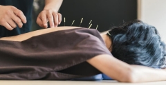 Beneficiile acupuncturii asupra sănătății organismului